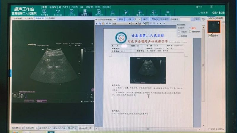 染色体检查：全面评估染色体结构